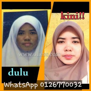 testimonial set kecantikkan shaklee