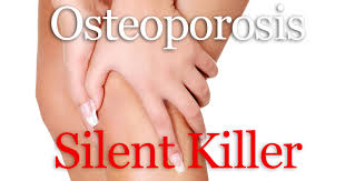 osteoporosis pembunuh wanita