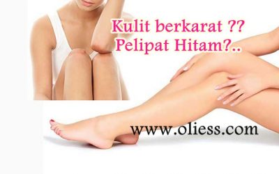 Vitamin C hilangkan karat kulit